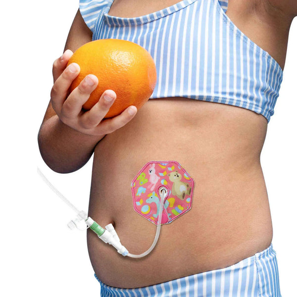 Μαξιλαράκια γαστροστομίας για παιδιά – Χαριτωμένα πολύχρωμα σχέδια & άνεση | Kaio-Tube Pads